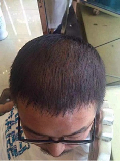 头发 脱发-花瓣网|陪你做生活的设计师 | xxfwfxa_!!0-rate.jpg_400x4