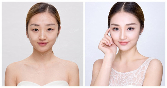 双眼皮真人案例新出炉的蜕变案例来啦从无神单眼皮到魅力大电眼效果就