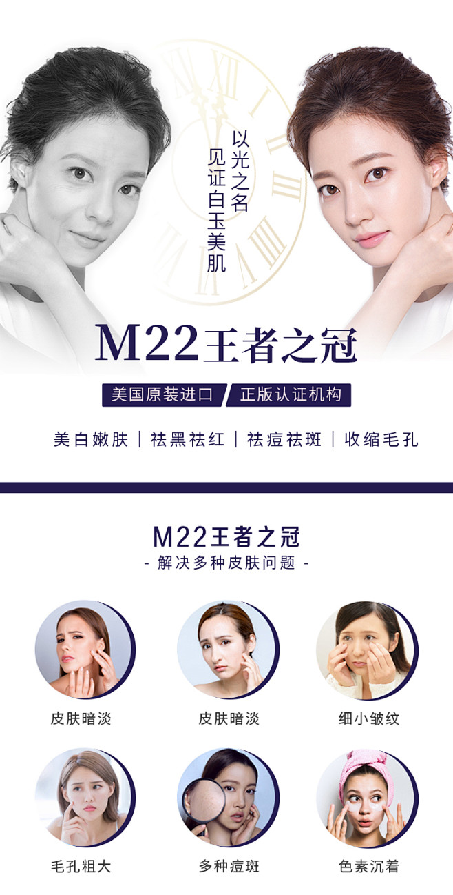瑞港医美光子嫩肤m22全模式王者之冠祛淡斑痘印美白收缩毛孔神器tmall