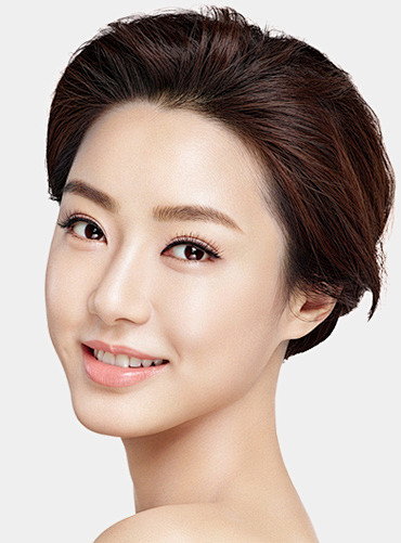 华美韩式综合美眼韩式双眼皮贵阳华美整形美容医院