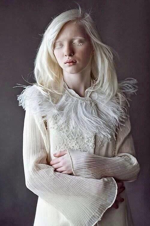 来自俄罗斯的16岁身患白化病的模特nastya被上帝赋予了另一种美拥有