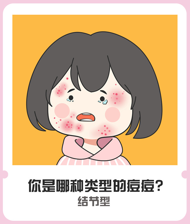 痘痘长痘祛痘感染型痘痘混合型痘痘结节型痘痘聚合型痘痘敏感型痘痘