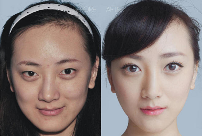 网曝多女子整容前后对比照惊人
